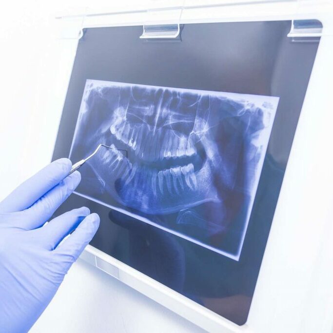 Hand in medical rubber gloves showing dental panoramic xray image.